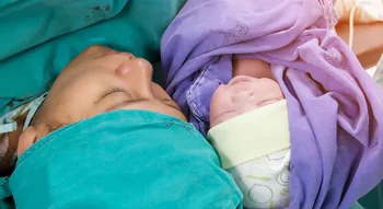 La césarienne en 7 questions : une mère rencontre son bébé juste après l'opération.