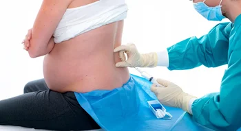 Injection d'une anesthésie péridurale pour une femme enceinte.