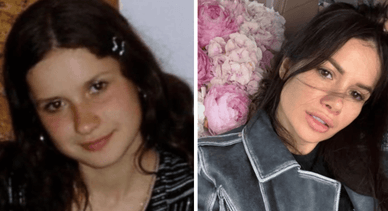 Шаманська Аліна до і після пластики