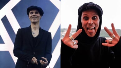 ville valo hampaat