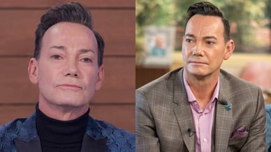 craig revel horwood face lift
