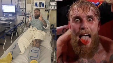 jake paul broken jaw