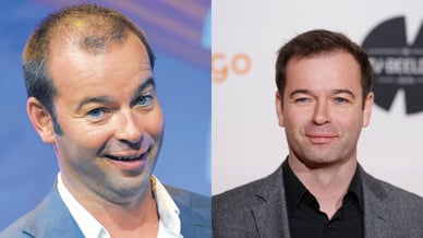 peter van der vorst haartransplantatie