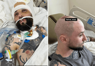 Віктор Розовий: важке поранення