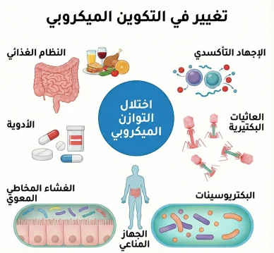 مخطط توضيحي شامل يظهر العوامل الرئيسية التي تسبب اختلال التوازن الميكروبي في الجسم مثل النظام الغذائي والأدوية وحالة الجهاز المناعي